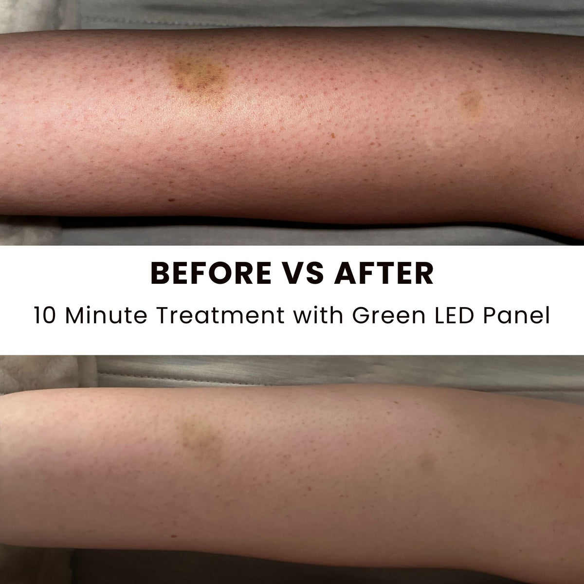Lumara Illuminate Green V1 – Green Light Therapy Panel