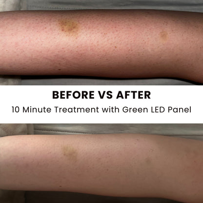 Lumara Illuminate Green V1 – Green Light Therapy Panel